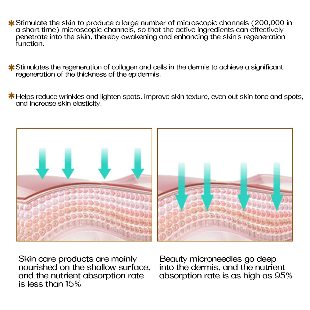 Lumivo Micro-Needling Derma Roller — 540 Titanium Needles